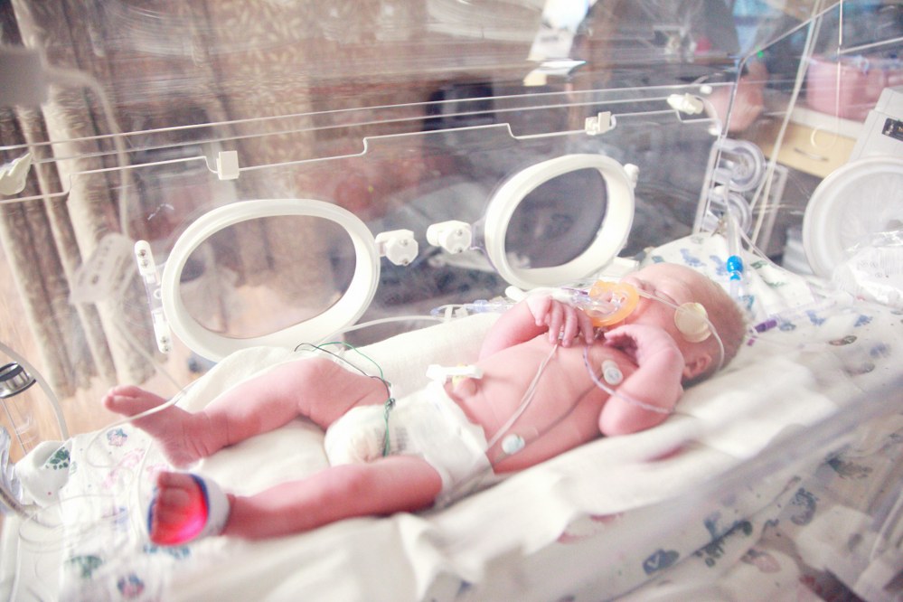 single parenting a premature baby in NICU